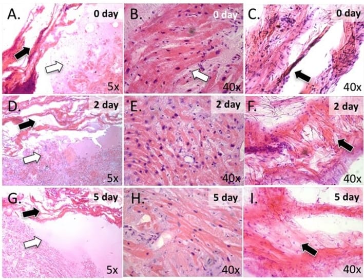 Rejuvenare vaginala, rejuvenare vaginală, Rejuvenare vaginala Rigenera,